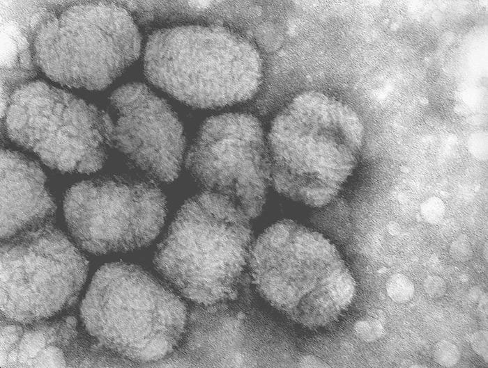 人類がウイルスに勝つことができたのは、天然痘だけで